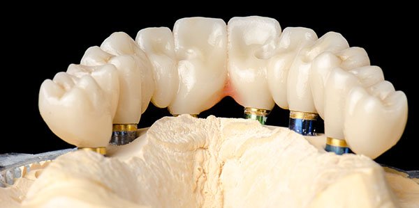 restorative dentistry warrnambool