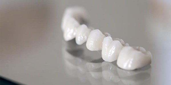 dental bridges in warrnambool