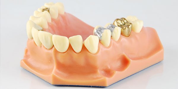 restorative dentistry warrnambool
