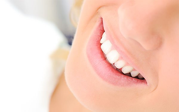 how safe is teeth whitening warrnambool