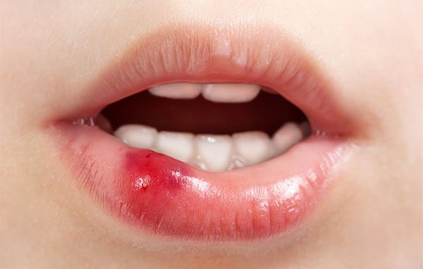 children's dental emergencies warrnambool