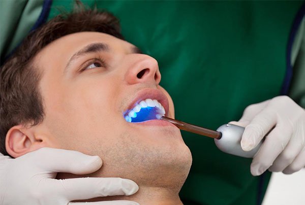 dental sealants warrnambool