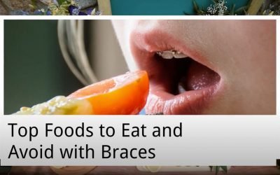 Top Foods to Eat and Avoid with Braces from Warrnambool Dental