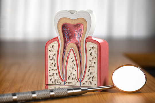 how will i know if i need a root canal warrnambool