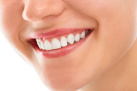 zoom whitening procedure warrnambool