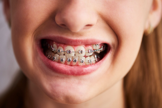 braces care warrnambool