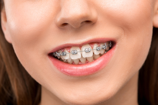 preventive orthodontics warrnambool