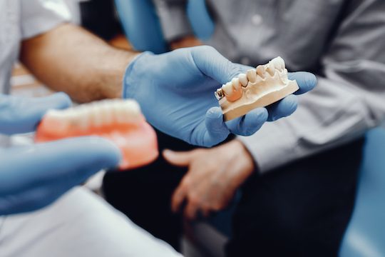 the denture-making process warrnambool