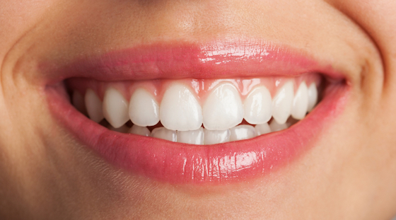 different types of tooth wear warrnambool