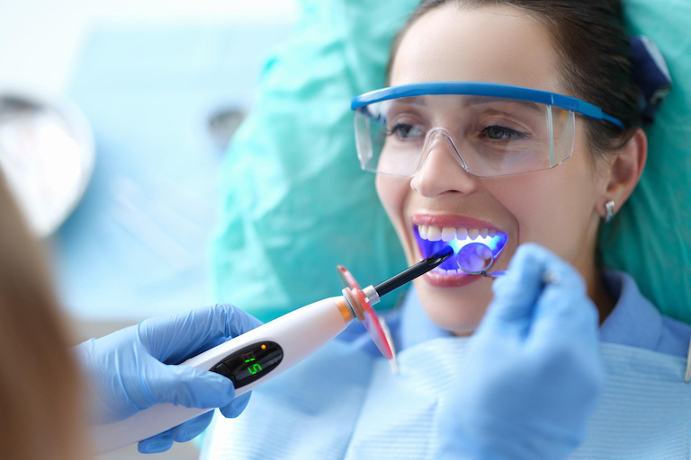 what are some of the benefits of dental bonding warrnambool