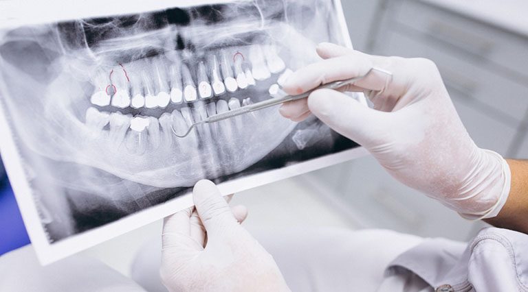 how does functional jaw orthopaedics treatment work warrnambool