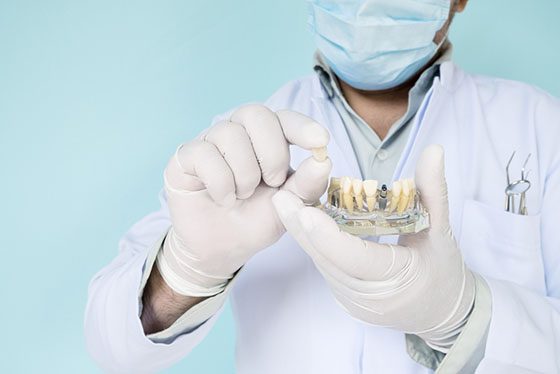 tooth replacement options warrnambool