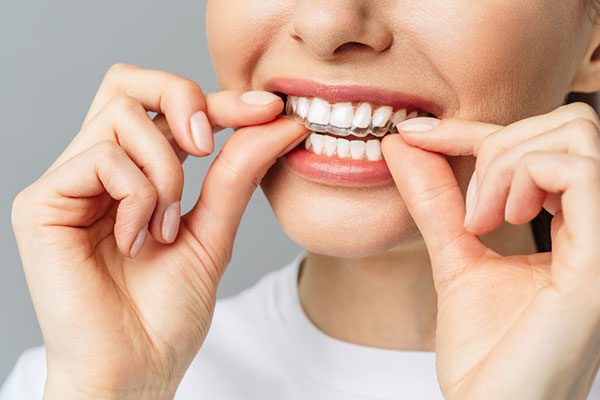 invisalign blurb dentist warrnambool