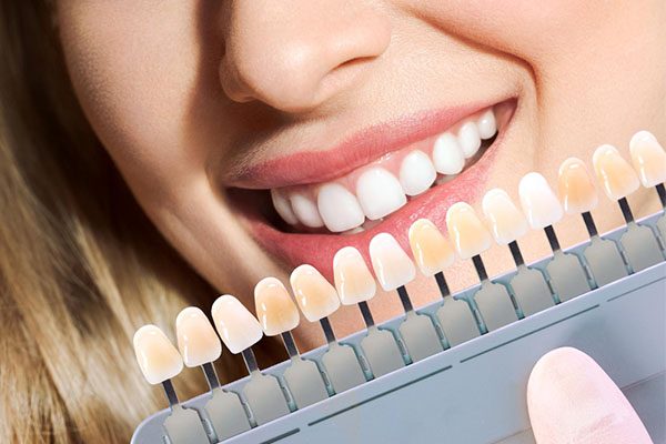 https://warrnambooldental.com.au/wp-content/uploads/2023/06/veneers-blurb-dentist-warrnambool.jpg