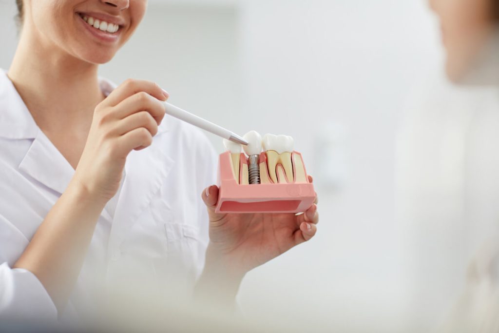 the complete guide to dental implants warrnambool dental