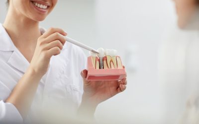 The Complete Guide to Dental Implants: Everything You Need to Know
