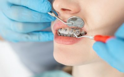 What is Orthodontics?: Exploring the Purpose and Practice
