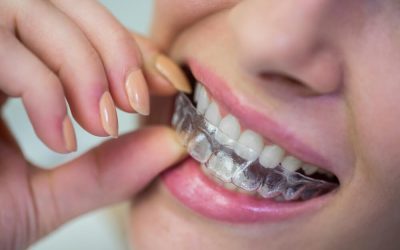 7 Reasons Why Invisalign is One of the Best Treatments for Straightening Teeth